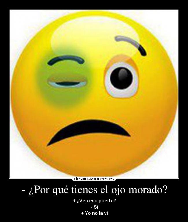 UN OJO MORADO un ojo morado: