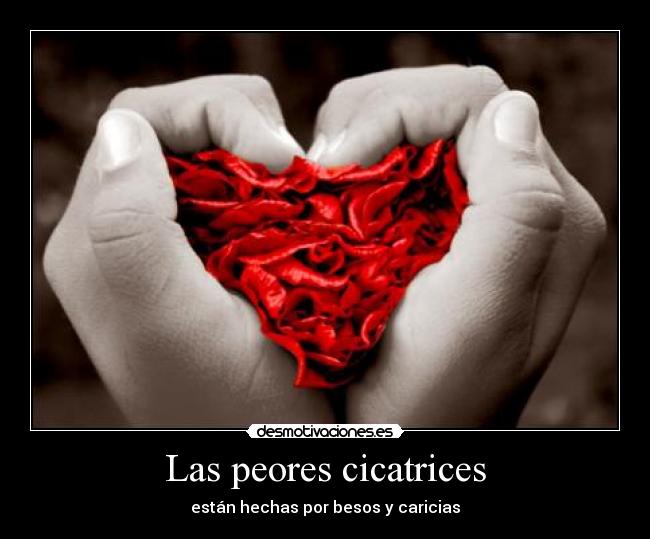 Las peores cicatrices - están hechas por besos y caricias