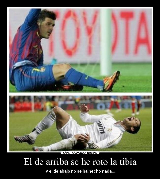 El de arriba se he roto la tibia - 