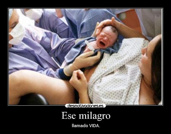 Ese milagro - 