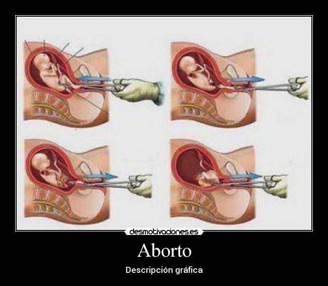 Aborto - Descripción gráfica
