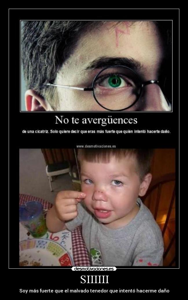 SIIIIII - Soy más fuerte que el malvado tenedor que intentó hacerme daño