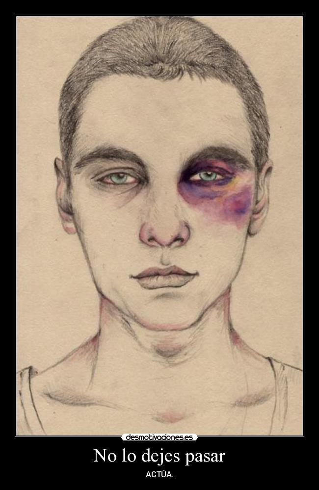 No lo dejes pasar - ACTÚA.
