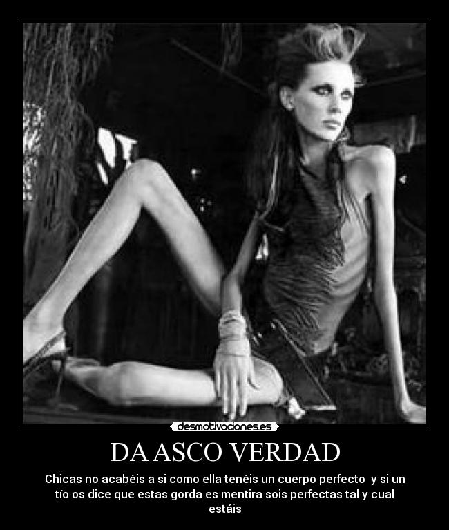 DA ASCO VERDAD -