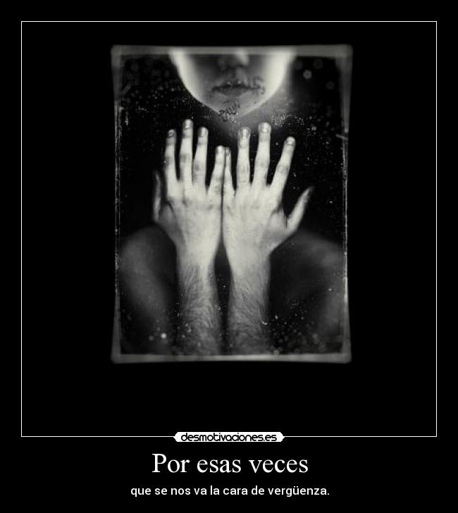 Por esas veces - que se nos va la cara de vergüenza.
