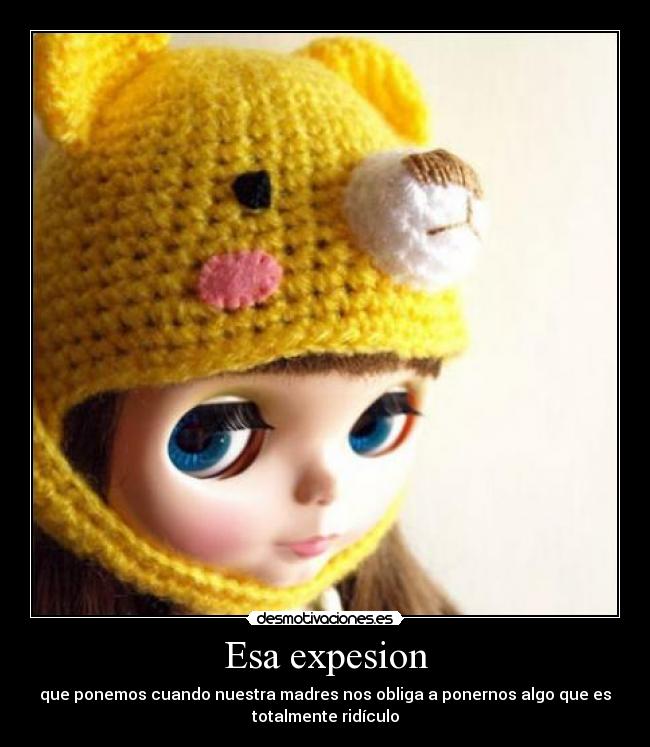 Esa expesion - que ponemos cuando nuestra madres nos obliga a ponernos algo que es
totalmente ridículo