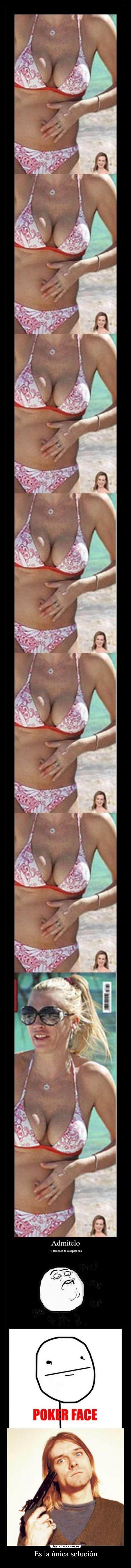 Es la única solución -