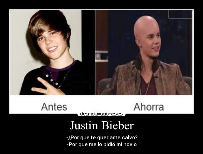 Justin Bieber - -¿Por que te quedaste calvo?
-Por que me lo pidió mi novio