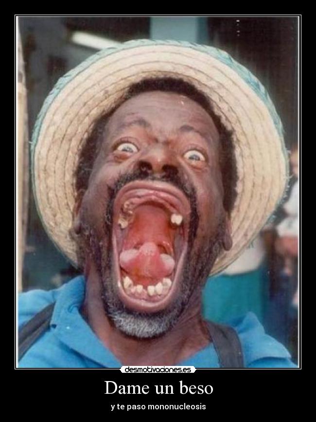 Dame un beso - y te paso mononucleosis
