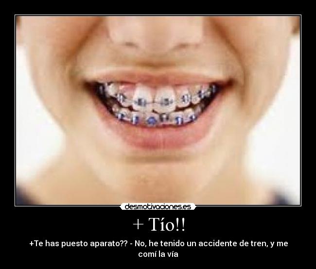 + Tío!! - +Te has puesto aparato?? - No, he tenido un accidente de tren, y me comí la vía