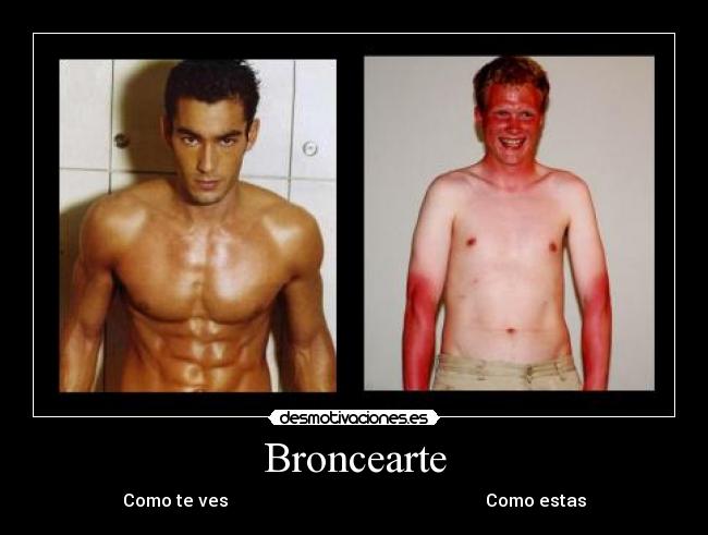Broncearte -