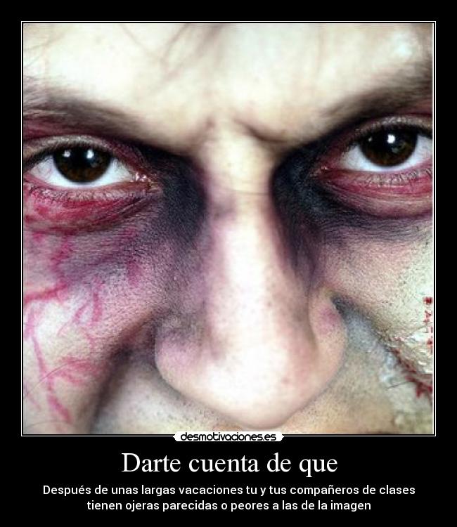 Darte cuenta de que - Después de unas largas vacaciones tu y tus compañeros de clases
tienen ojeras parecidas o peores a las de la imagen