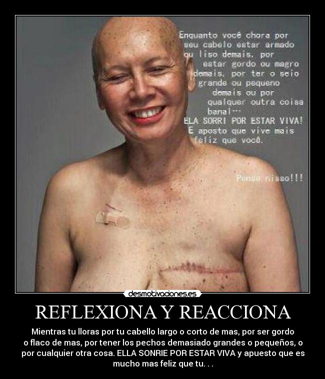 REFLEXIONA Y REACCIONA - Mientras tu lloras por tu cabello largo o corto de mas, por ser gordo
o flaco de mas, por tener los pechos demasiado grandes o pequeños, o
por cualquier otra cosa. ELLA SONRIE POR ESTAR VIVA y apuesto que es
mucho mas feliz que tu. . .