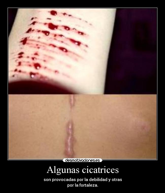 Algunas cicatrices - 