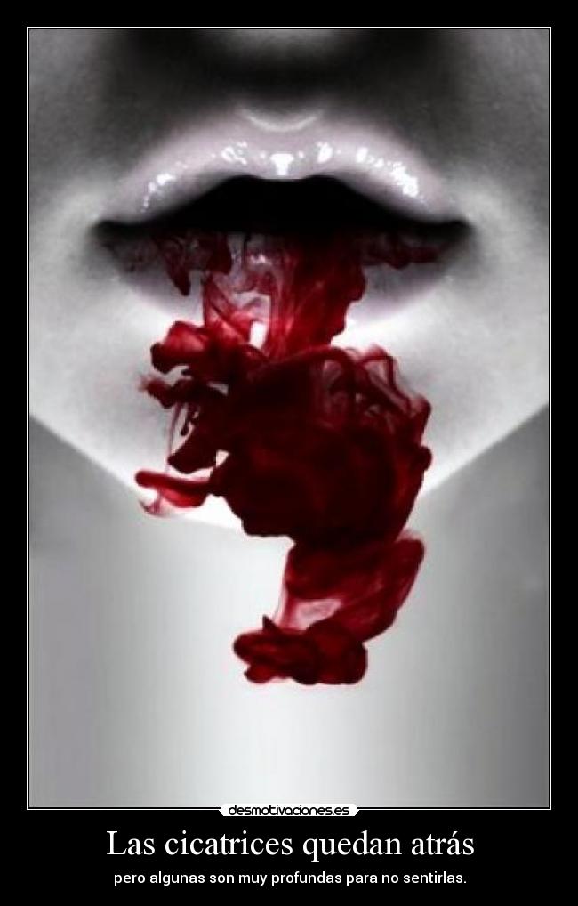 Las cicatrices quedan atrás - pero algunas son muy profundas para no sentirlas.