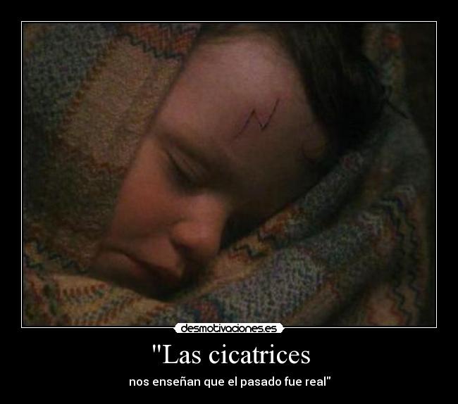 Las cicatrices - nos enseñan que el pasado fue real