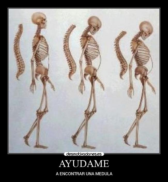 AYUDAME - A ENCONTRAR UNA MEDULA