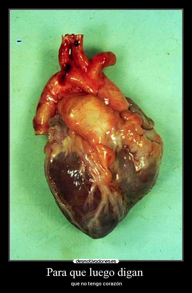 carteles asasdasdasadadchadadsasdasdas rapid clanhoygan clancii desmotivaciones