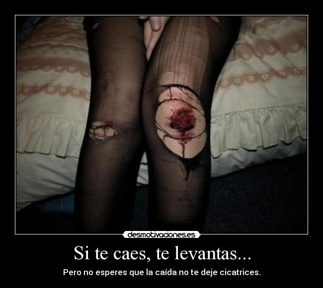 Si te caes, te levantas... -