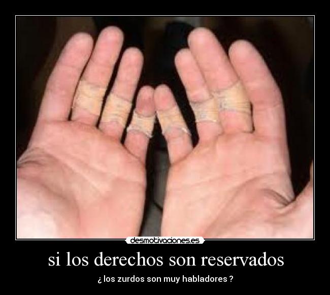 si los derechos son reservados -