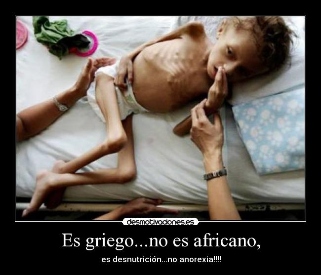 Es griego...no es africano, - es desnutrición...no anorexia!!!!