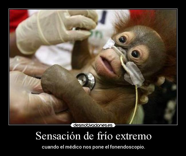 Sensación de frío extremo - 