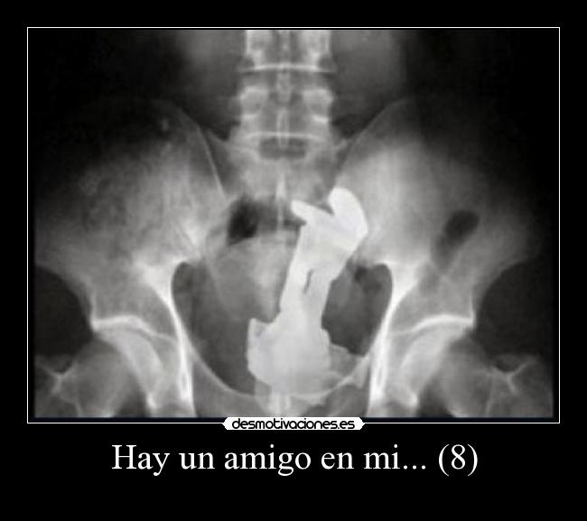 Hay un amigo en mi... (8) -