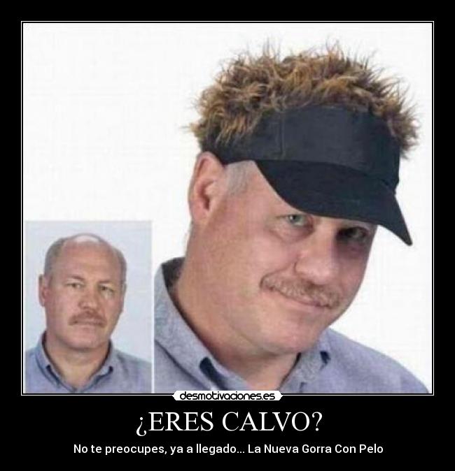 ¿ERES CALVO? - No te preocupes, ya a llegado... La Nueva Gorra Con Pelo
