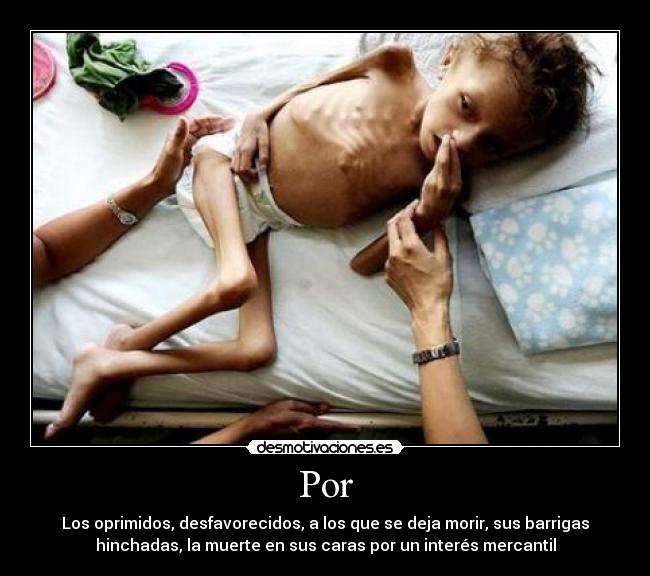Por - Los oprimidos, desfavorecidos, a los que se deja morir, sus barrigas
hinchadas, la muerte en sus caras por un interés mercantil