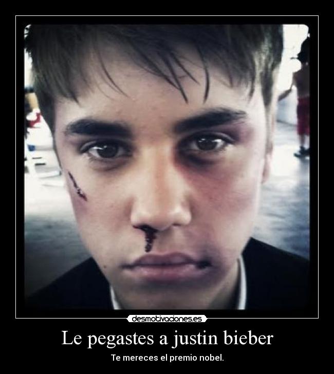 Le pegastes a justin bieber -