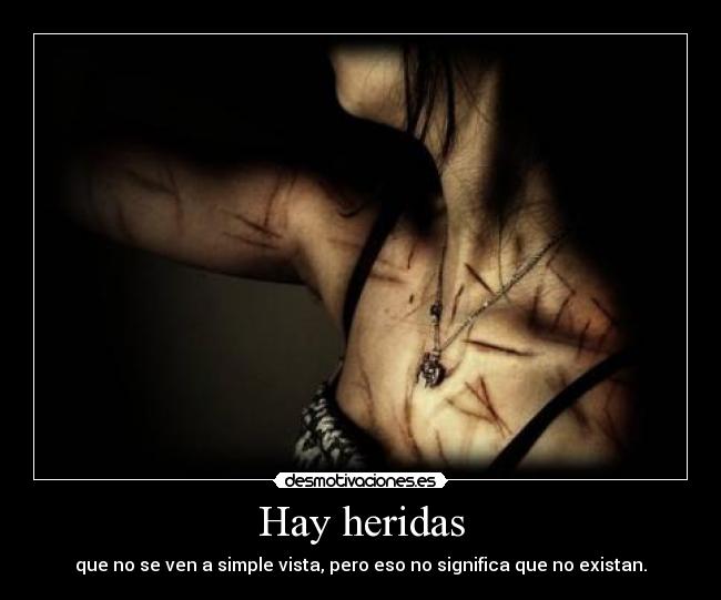 Hay heridas - que no se ven a simple vista, pero eso no significa que no existan.
