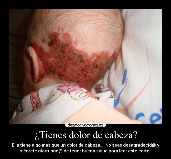¿Tienes dolor de cabeza? - Ella tiene algo mas que un dolor de cabeza... No seas desagradecid@ y
siéntete afortunad@ de tener buena salud para leer este cartel.