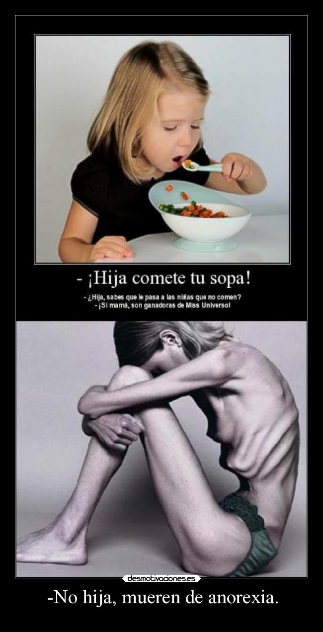 -No hija, mueren de anorexia. - 