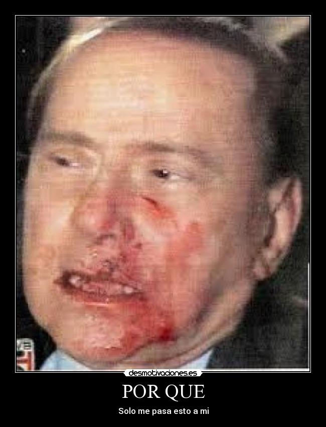 POR QUE - Solo me pasa esto a mi