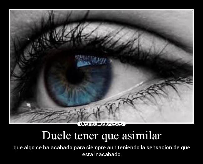Duele tener que asimilar -
