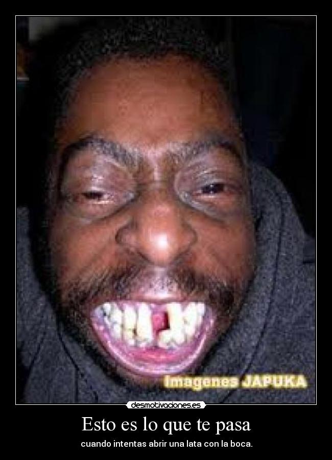 Esto es lo que te pasa - cuando intentas abrir una lata con la boca.