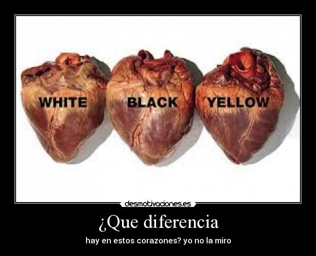 ¿Que diferencia -