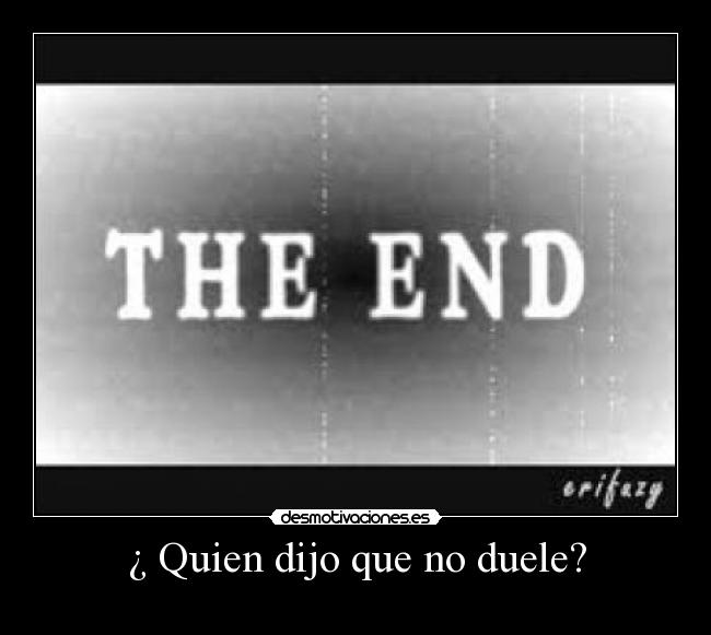 ¿ Quien dijo que no duele? -