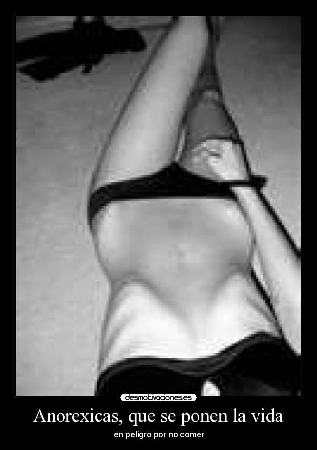Anorexicas, que se ponen la vida - en peligro por no comer