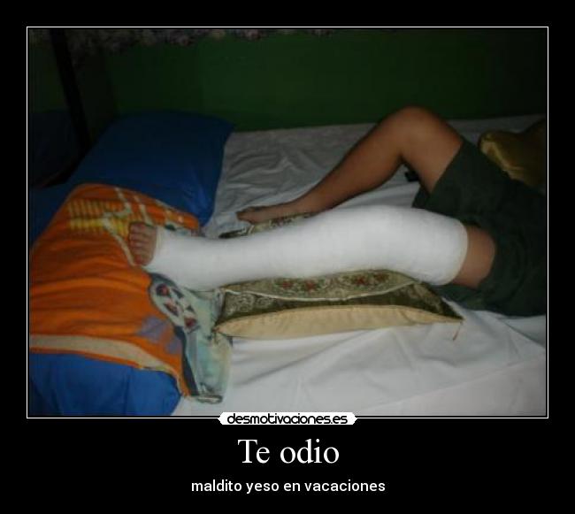 Te odio - maldito yeso en vacaciones