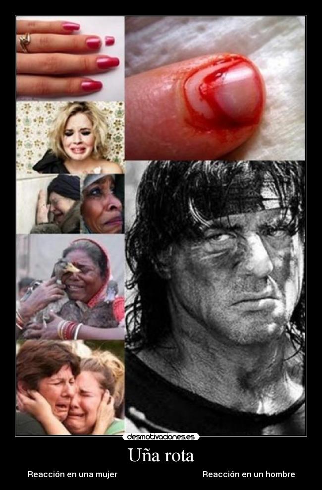 Uña rota -