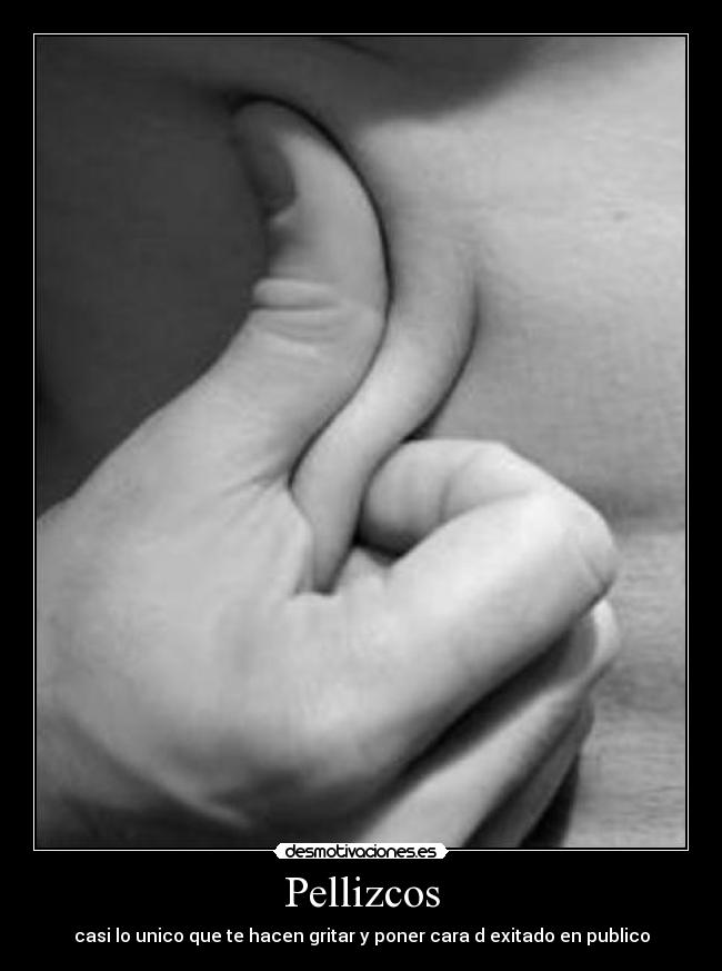 Pellizcos -
