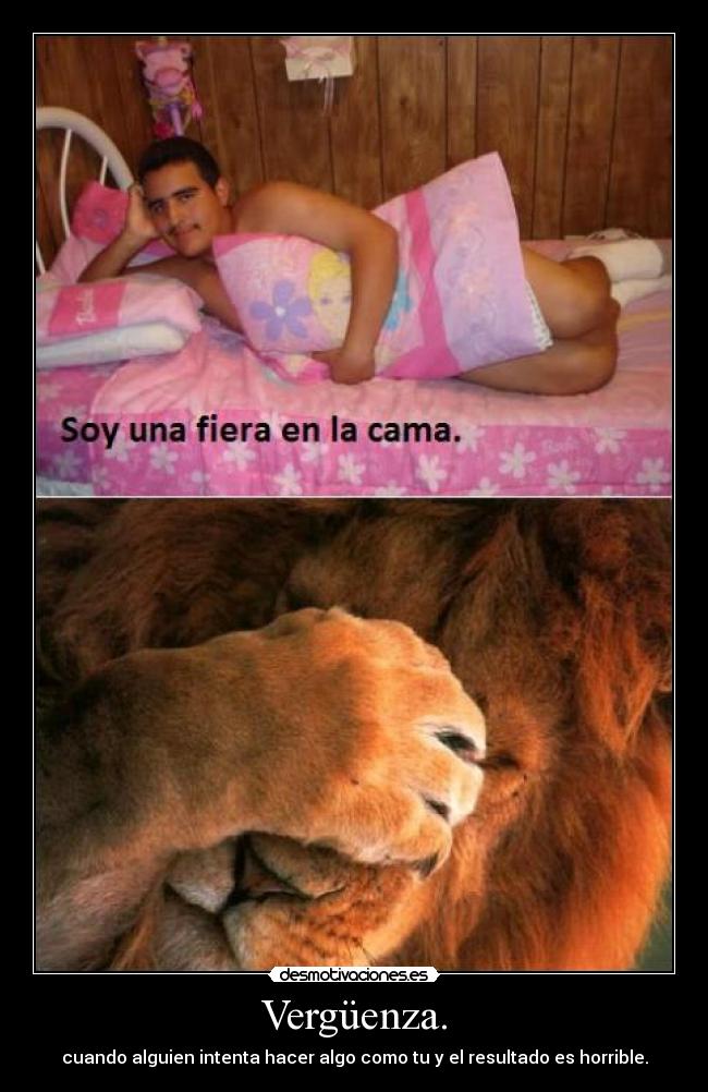 Vergüenza. - 