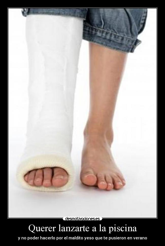 Querer lanzarte a la piscina - y no poder hacerlo por el maldito yeso que te pusieron en verano