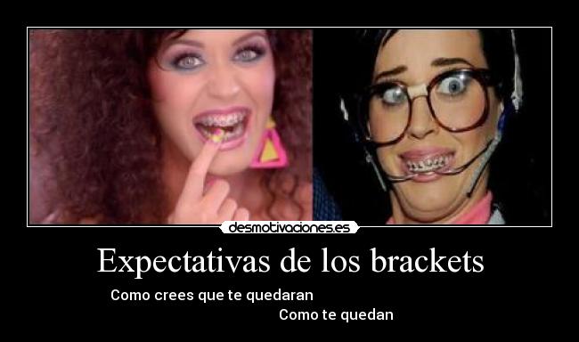 Expectativas de los brackets - 