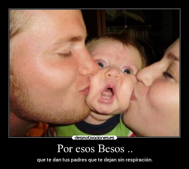 Por esos Besos .. -