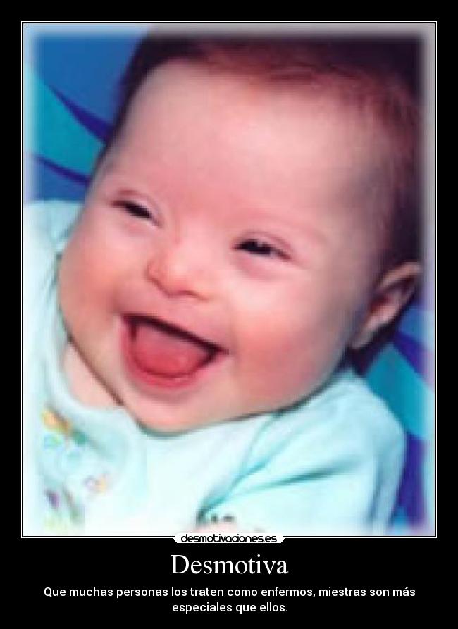 Desmotiva - Que muchas personas los traten como enfermos, miestras son más
especiales que ellos.
