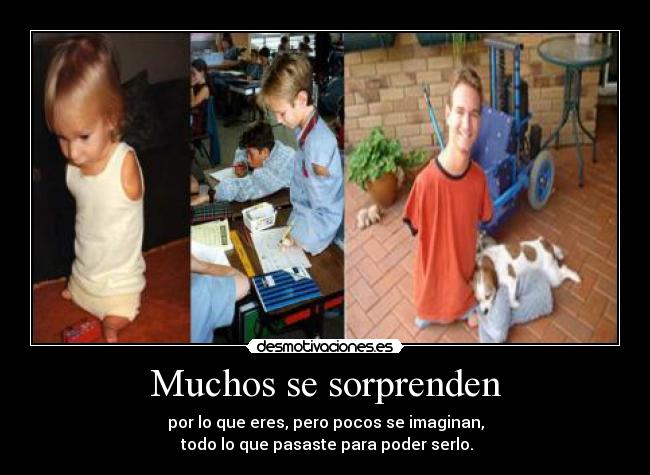 Muchos se sorprenden - 