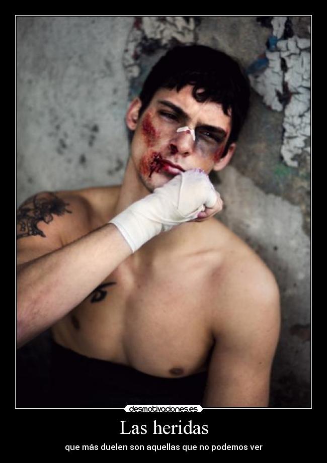 Las heridas -