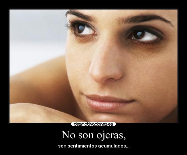 No son ojeras, -